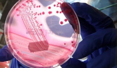 Prostat Kanseri Farkındalığı ve Kapalı Ameliyatlarla Etkili Tedavi Yaklaşımları